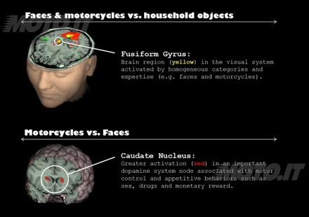brain scans